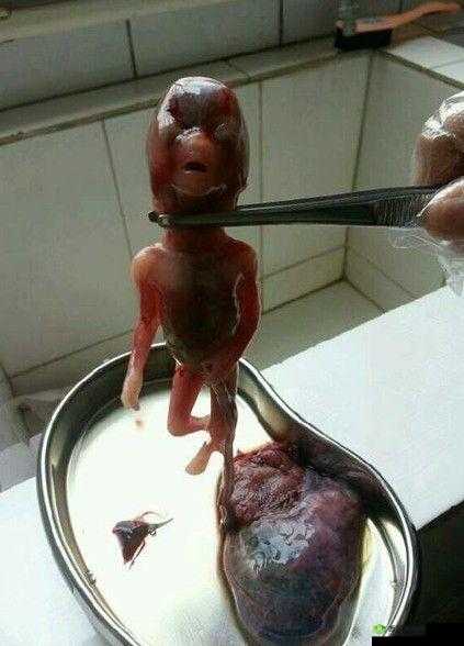 胎头湿漉漉挤出：生命诞生的震撼瞬间